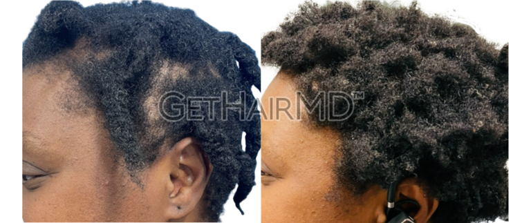 GHMD_Female-101_SidebySide-W