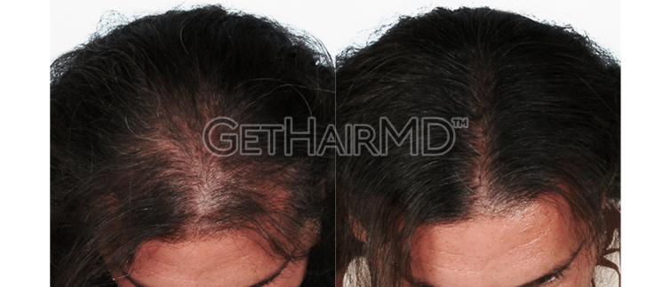 GHMD_Female-110_SidebySide-W